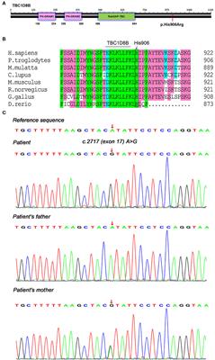 Novel TBC1D8B Variant in a 6-Month-Old Boy With Steroid-Sensitive Nephrotic Syndrome: A Case Report